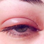 फैलिँदै गएको आँखा पाक्ने रोगबाट बच्न सिन्धुलीको कमलामाई नगरपालिकाका विद्यालय पाँच दिन बन्द