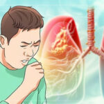 विश्वमा एक करोड सात लाख क्षयरोगी, नेपालमा कति ?